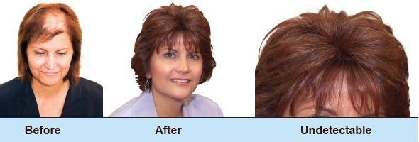 Before and After Women Before and After Women