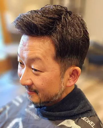 01 mens hair restoration systems before and after photo 01 solutions before after mens gallery hair restoration systems 01 mens hair restoration systems before and after photo 01