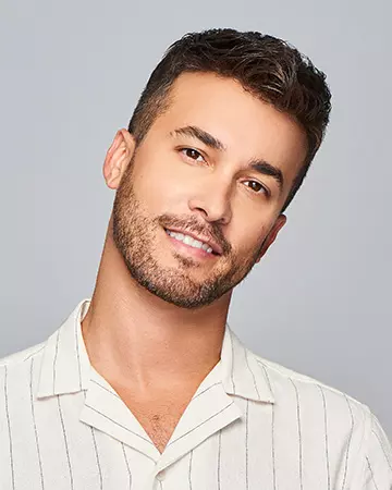 07 mens hair restoration systems before and after photo 01 solutions before after mens gallery hair restoration systems 07 mens hair restoration systems before and after photo 01