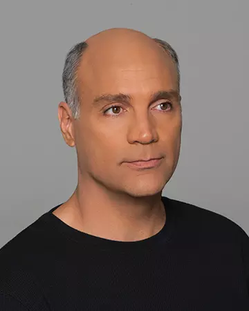 10 mens hair restoration systems before and after photo 02 solutions before after mens gallery hair restoration systems 10 mens hair restoration systems before and after photo 02
