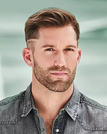 11 mens hair restoration systems before and after photo 01 solutions before after mens gallery hair restoration systems 11 mens hair restoration systems before and after photo 01