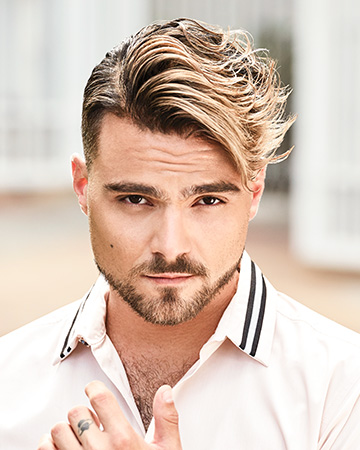   solutions before after mens gallery hair restoration systems 02 mens hair restoration systems before and after photo 01