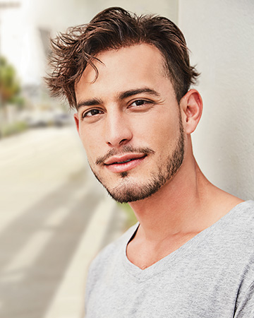   solutions before after mens gallery hair restoration systems 03 mens hair restoration systems before and after photo 01