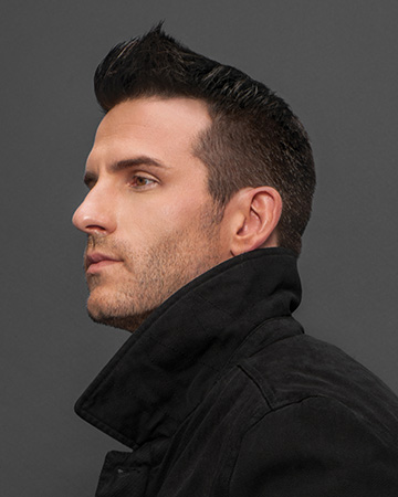   solutions before after mens gallery hair restoration systems 04 mens hair restoration systems before and after photo 01