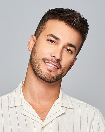   solutions before after mens gallery hair restoration systems 07 mens hair restoration systems before and after photo 01