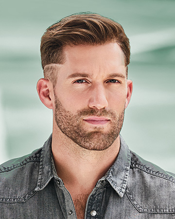   solutions before after mens gallery hair restoration systems 11 mens hair restoration systems before and after photo 01