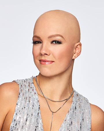   solutions before after womens gallery wigs 02 wigs before and after photo 02