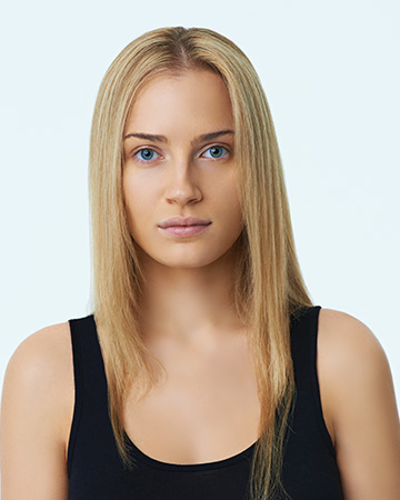   solutions before after womens gallery wigs 07 wigs before and after photo 02